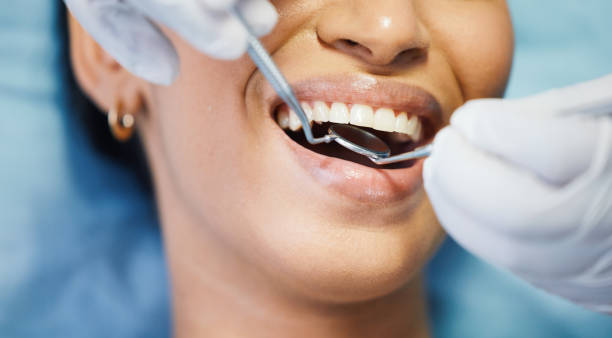 Best Emergency Wisdom Teeth Removal in Nolanville, TX