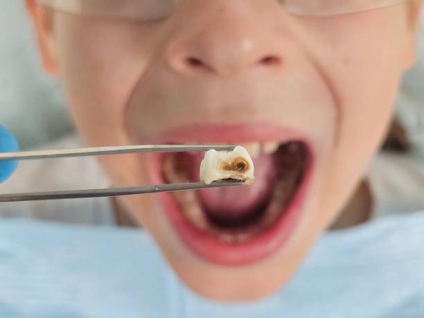 Best Same-Day Emergency Dentist in Nolanville, TX